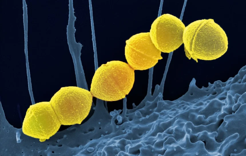 Microbiome